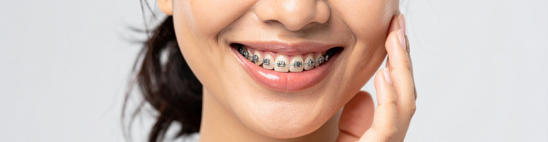 Woman's smile with metal braces.